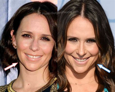 Jennifer Love Hewitt: Before and After